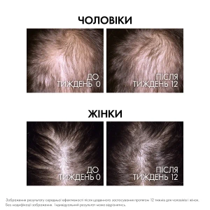 VICHY 2080 ДЕРКОС АМИНЕКСИЛ КЛИНИКАЛ РИДЖЕН БУСТЕР СЫВОРОТКА П/ВЫПАД.ВОЛОС 90МЛ