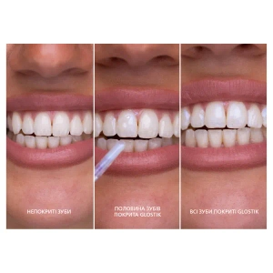 СМАЙЛКИТ SMILEKIT СТИК ДЛЯ БЛЕСКА ЗУБОВ 4МЛ  1692