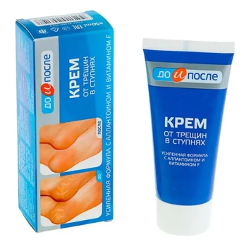ДО И ПОСЛЕ КРЕМ Д/НОГ ОТ ТРЕЩИН В СТУПНЯХ 150МЛ  0185